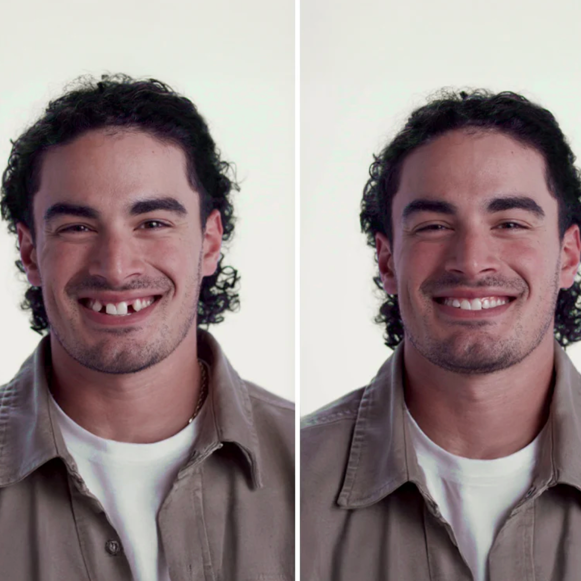 MendDental Smile Restoration Kit