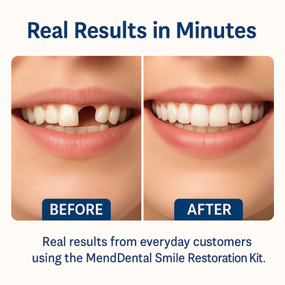 MendDental Smile Restoration Kit